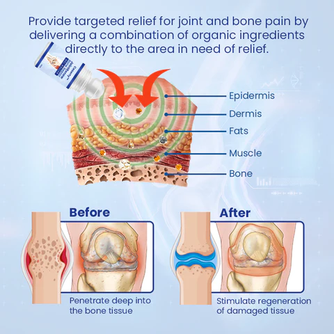 JointRenew™ Bone Repair Gel Roller