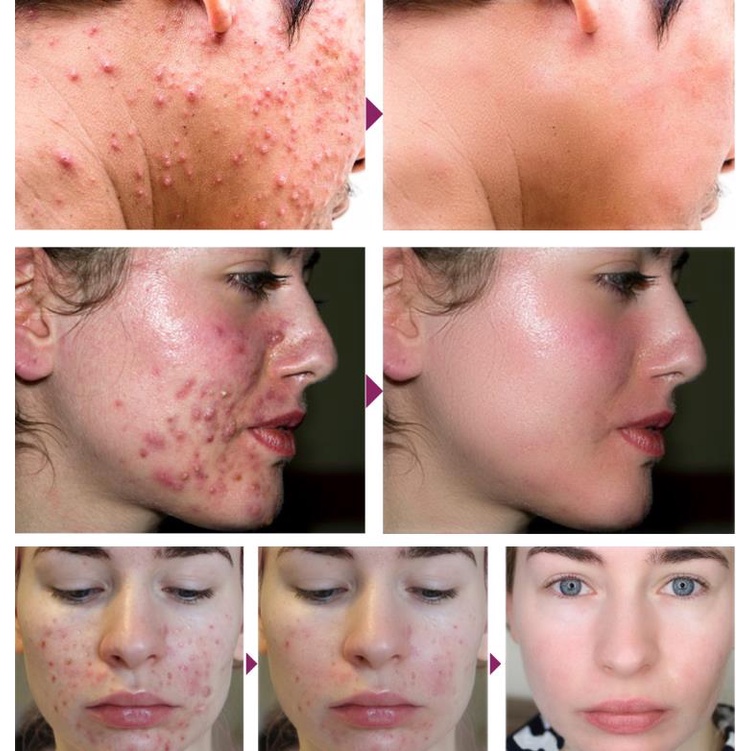 REPAIR YOUR FACE